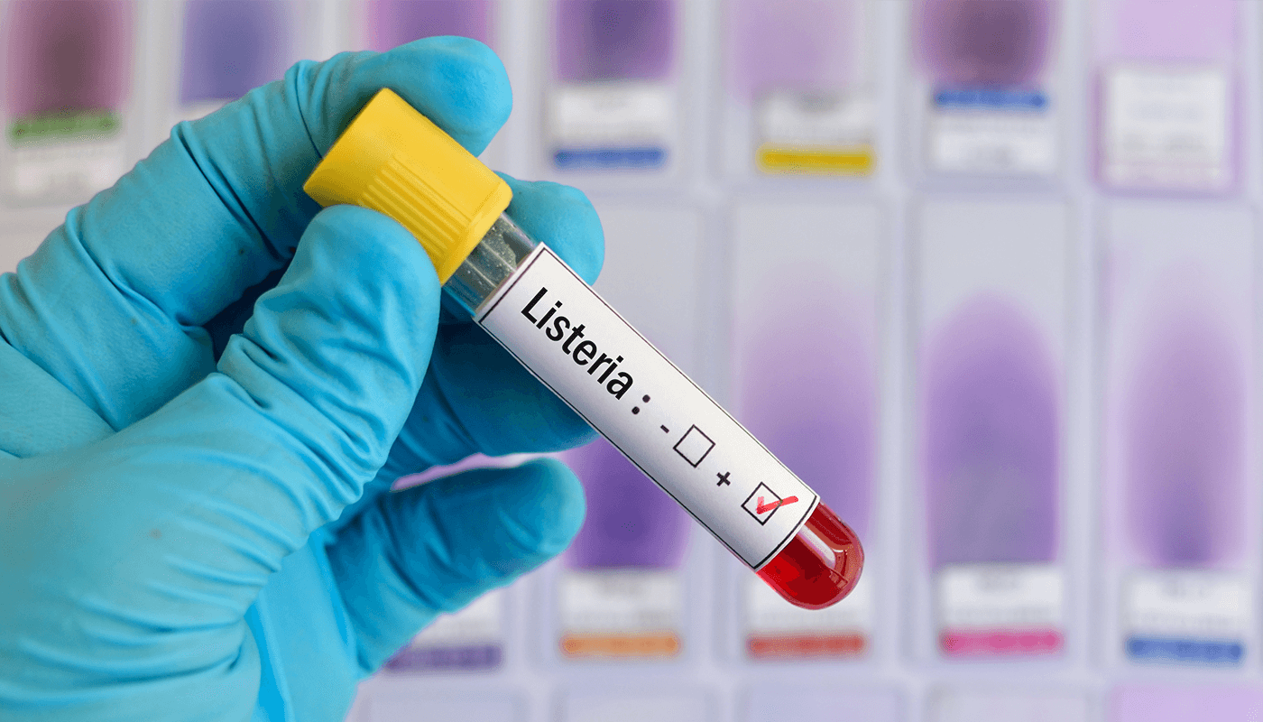 Preventing Listeria